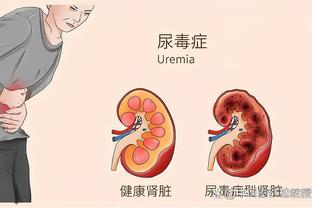 迪奥：恩比德曾说他想为法国队效力 我们听了他的话